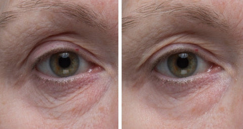 Dr. Denese Firming Facial Collagen Eye Cream 1 oz & HydroBurst Eye Gel Mask
