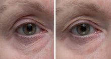 Load image into Gallery viewer, Dr. Denese Firming Facial Collagen Eye Cream 1 oz &amp; HydroBurst Eye Gel Mask
